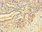 Schlafen Family Member 11 antibody, CSB-PA021760LA01HU, Cusabio, Immunohistochemistry paraffin image 
