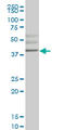 Hematopoietically-expressed homeobox protein HHEX antibody, LS-C197408, Lifespan Biosciences, Western Blot image 