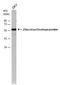 Zika Virus antibody, GTX634155-01, GeneTex, Western Blot image 
