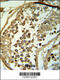 Chromosome 19 Open Reading Frame 18 antibody, 64-134, ProSci, Immunohistochemistry paraffin image 