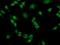 Phosphoglycerate Mutase 2 antibody, NBP2-01142, Novus Biologicals, Immunocytochemistry image 