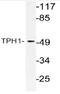 Tryptophan Hydroxylase 1 antibody, AP21097PU-N, Origene, Western Blot image 
