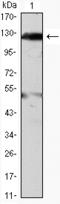 Janus Kinase 2 antibody, AM06439SU-N, Origene, Western Blot image 