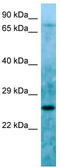 LBH Domain Containing 1 antibody, TA331749, Origene, Western Blot image 