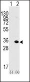 Methyl-CpG Binding Domain Protein 3 antibody, 55-160, ProSci, Western Blot image 