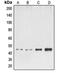 ETS Transcription Factor ELK1 antibody, orb213892, Biorbyt, Western Blot image 