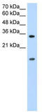 Heterogeneous nuclear ribonucleoprotein U-like protein 1 antibody, TA343995, Origene, Western Blot image 