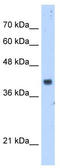 Decaprenyl-diphosphate synthase subunit 1 antibody, TA339313, Origene, Western Blot image 