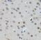 MYCN Proto-Oncogene, BHLH Transcription Factor antibody, FNab05460, FineTest, Immunohistochemistry frozen image 