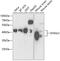 SH3 Domain Containing GRB2 Like 2, Endophilin A1 antibody, GTX32872, GeneTex, Western Blot image 