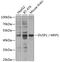 Dual Specificity Phosphatase 1 antibody, GTX54042, GeneTex, Western Blot image 