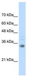 Homeobox protein Hox-B4 antibody, TA345378, Origene, Western Blot image 
