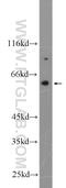 NADPH oxidase 5 antibody, 25350-1-AP, Proteintech Group, Western Blot image 