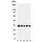 Mitochondrial brown fat uncoupling protein 1 antibody, R31088, NSJ Bioreagents, Western Blot image 