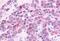 Hormonally up-regulated neu tumor-associated kinase antibody, MBS243208, MyBioSource, Immunohistochemistry paraffin image 
