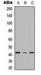 Stearoyl-CoA Desaturase antibody, MBS8231781, MyBioSource, Western Blot image 