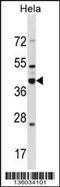 DND MicroRNA-Mediated Repression Inhibitor 1 antibody, 58-546, ProSci, Western Blot image 