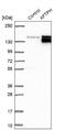 Aftiphilin antibody, NBP1-82209, Novus Biologicals, Western Blot image 
