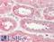 Stromal Interaction Molecule 2 antibody, LS-B10816, Lifespan Biosciences, Immunohistochemistry paraffin image 