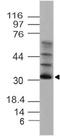 Solute Carrier Family 25 Member 27 antibody, A09782, Boster Biological Technology, Western Blot image 