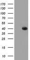 UDP-Galactose-4-Epimerase antibody, MBS830573, MyBioSource, Western Blot image 