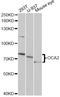 OCA2 Melanosomal Transmembrane Protein antibody, STJ27620, St John