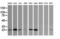 Ubiquitin-conjugating enzyme E2 S antibody, M03045, Boster Biological Technology, Western Blot image 