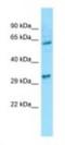 Etoposide-induced protein 2.4 antibody, NBP1-98605, Novus Biologicals, Western Blot image 
