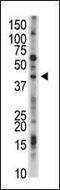 Ubiquitin Specific Peptidase 12 antibody, PA5-12011, Invitrogen Antibodies, Western Blot image 