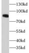 Catenin beta-1 antibody, FNab09871, FineTest, Western Blot image 
