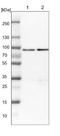 HSD17B4 antibody, NBP1-85296, Novus Biologicals, Western Blot image 