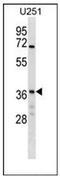 NSF Attachment Protein Gamma antibody, AP52808PU-N, Origene, Western Blot image 
