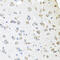 Amyloid P Component, Serum antibody, 18-435, ProSci, Immunohistochemistry paraffin image 