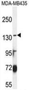 Canalicular multispecific organic anion transporter 2 antibody, AP50015PU-N, Origene, Western Blot image 