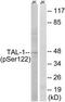 TAL BHLH Transcription Factor 1, Erythroid Differentiation Factor antibody, TA313029, Origene, Western Blot image 