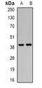 Polycomb Group Ring Finger 6 antibody, orb340967, Biorbyt, Western Blot image 