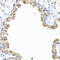 Collagen Type X Alpha 1 Chain antibody, 22-532, ProSci, Immunohistochemistry frozen image 