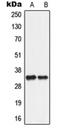 Solute Carrier Family 25 Member 5 antibody, orb213555, Biorbyt, Western Blot image 