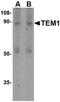 CD248 Molecule antibody, orb74896, Biorbyt, Western Blot image 