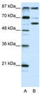 Lysine Acetyltransferase 2B antibody, TA330554, Origene, Western Blot image 