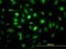 ZW10 Interacting Kinetochore Protein antibody, H00011130-M01, Novus Biologicals, Immunofluorescence image 