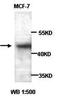 Adiponectin Receptor 1 antibody, orb77021, Biorbyt, Western Blot image 