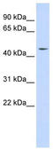 Integrator Complex Subunit 12 antibody, TA339150, Origene, Western Blot image 