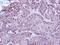 Histone-lysine N-methyltransferase SUV39H1 antibody, PA5-29470, Invitrogen Antibodies, Immunohistochemistry paraffin image 