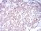 Neurotrophic Receptor Tyrosine Kinase 2 antibody, NBP2-52524, Novus Biologicals, Immunohistochemistry paraffin image 
