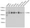 Coatomer Protein Complex Subunit Beta 1 antibody, GTX65917, GeneTex, Western Blot image 