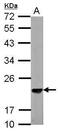 S-Phase Kinase Associated Protein 1 antibody, PA5-28489, Invitrogen Antibodies, Western Blot image 