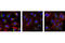 Microtubule Associated Protein 1 Light Chain 3 Beta antibody, 13082S, Cell Signaling Technology, Immunofluorescence image 