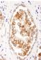 ATP Binding Cassette Subfamily B Member 9 antibody, A301-997A, Bethyl Labs, Immunohistochemistry frozen image 
