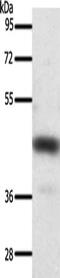 Sst2 antibody, CSB-PA260413, Cusabio, Western Blot image 